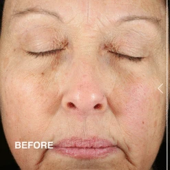 Anti-Aging Regenerative Day Cream -Innisfree Store BA DE ANTIWRINKLE R1122 1430b6e2 d1df 4916 9898 a275327d15d4