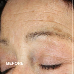 Ultra Lift DMAE Concentrated Serum -Innisfree Store BA DE FIRMWEB R1023