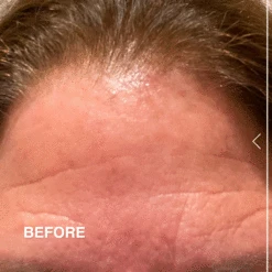 Stem Cell Lifting Eye Treatment -Innisfree Store BA DE FIRM R1122