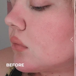 Pure Biome Balancing Serum -Innisfree Store BA DE PUREBIOMEWEB R0223