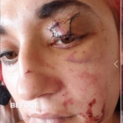 Scar Gel -Innisfree Store BA DE SCARGELWEB R0223