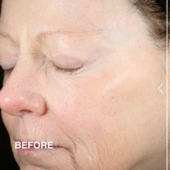 Advanced Peptides And Flora-Collagen™ Serum -Innisfree Store BA DE SKINRESTORE R1122 39a4c9e2 895b 4aa6 991f 15fefc64346b